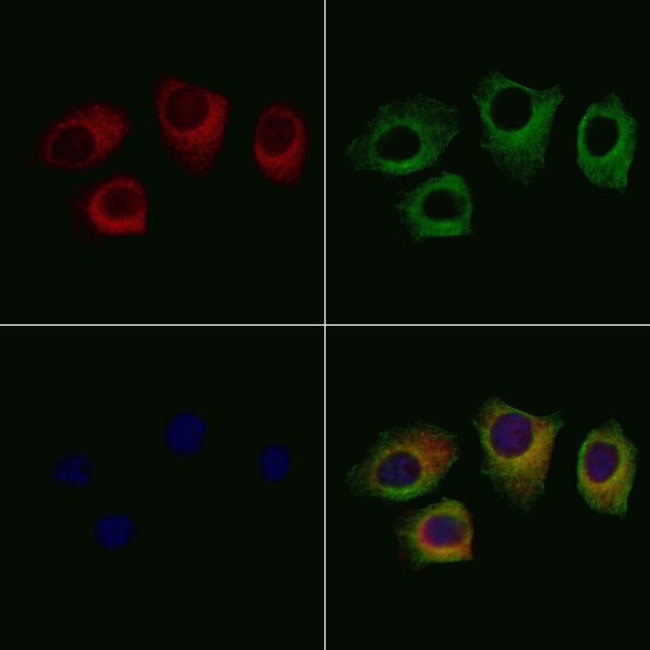 SEPT2 Antibody in Immunocytochemistry (ICC/IF)