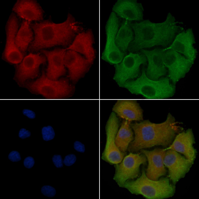 SEPT6 Antibody in Immunocytochemistry (ICC/IF)