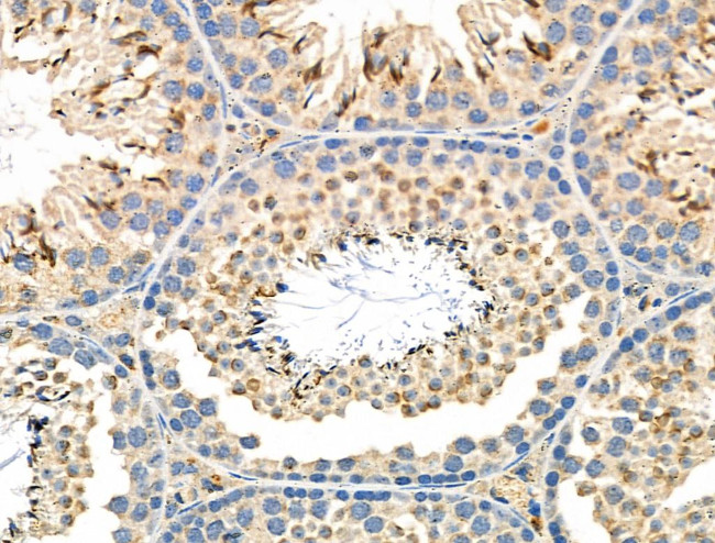 STK32C Antibody in Immunohistochemistry (Paraffin) (IHC (P))