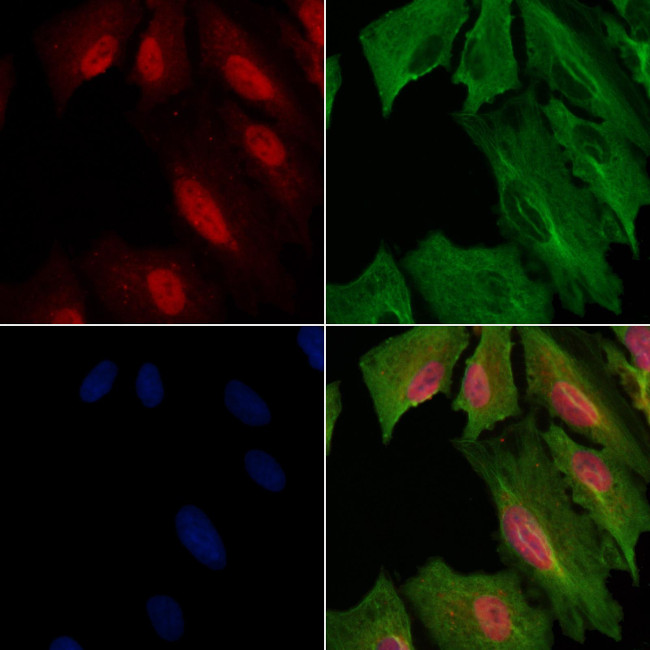 PPP4R1L Antibody in Immunocytochemistry (ICC/IF)