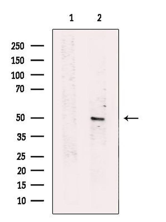 SERPINA11 Antibody in Western Blot (WB)