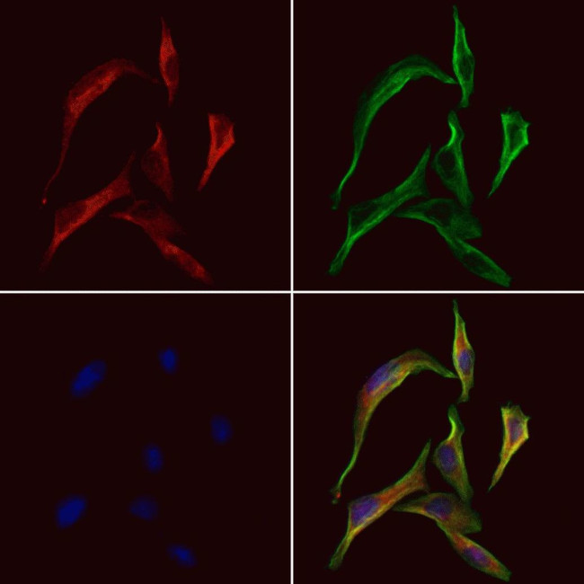 SH3GLB2 Antibody in Immunocytochemistry (ICC/IF)