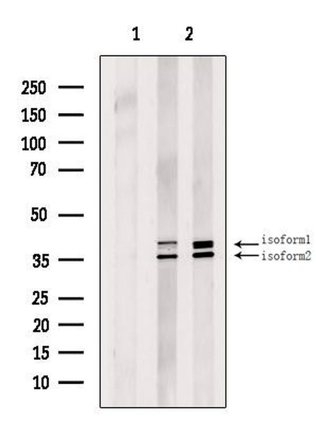 GTF3A Antibody in Western Blot (WB)