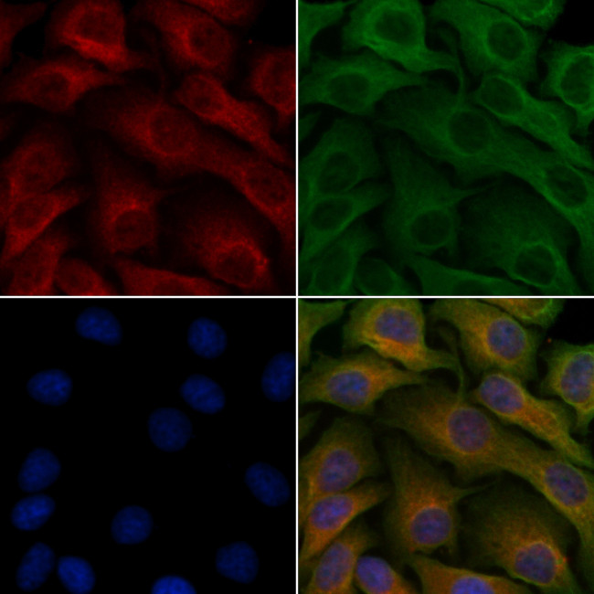 Ubiquilin 3 Antibody in Immunocytochemistry (ICC/IF)