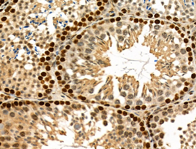 USP30 Antibody in Immunohistochemistry (Paraffin) (IHC (P))