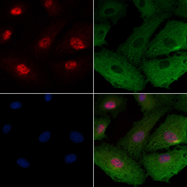 ZNF50 Antibody in Immunocytochemistry (ICC/IF)