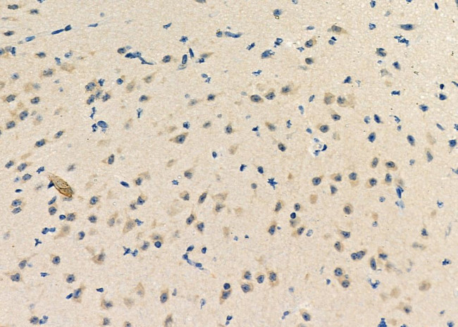 ZNF292 Antibody in Immunohistochemistry (Paraffin) (IHC (P))