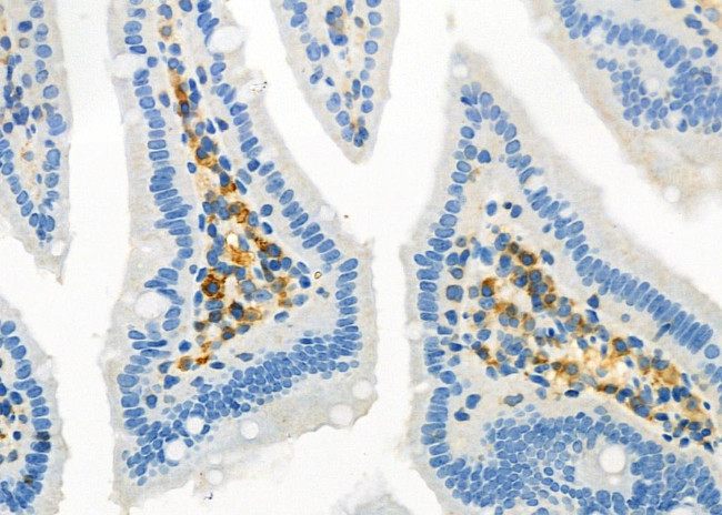 RNF130 Antibody in Immunohistochemistry (Paraffin) (IHC (P))