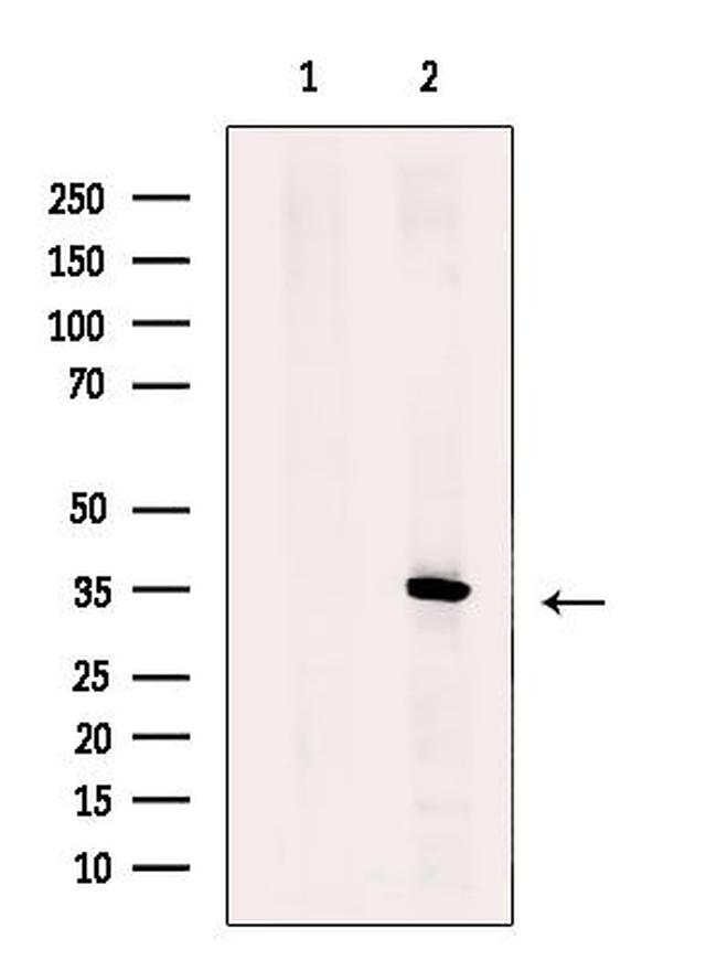 ZNF691 Antibody in Western Blot (WB)