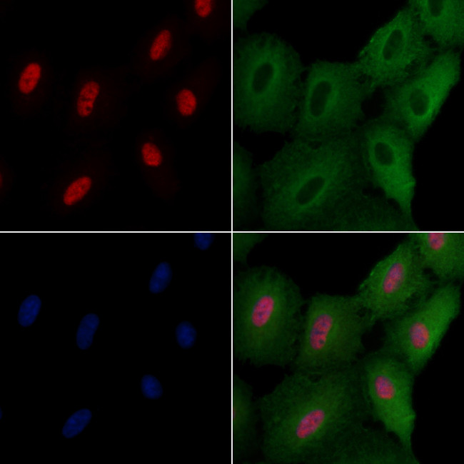 ELF4 Antibody in Immunocytochemistry (ICC/IF)