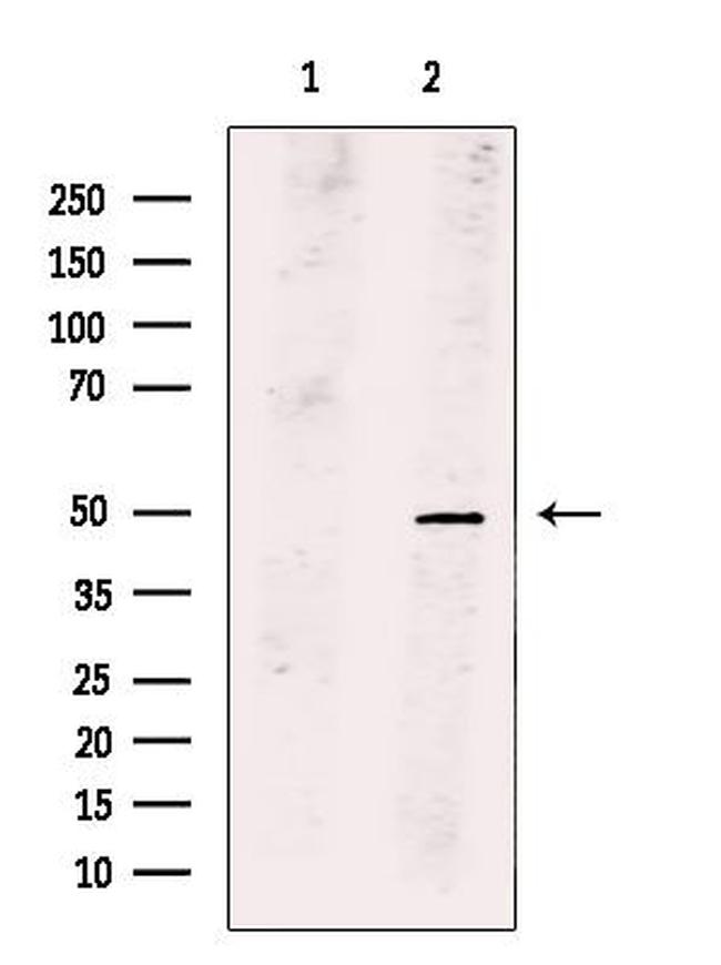 PLAGL1 Antibody in Western Blot (WB)