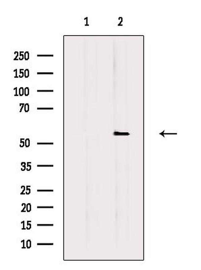 FGFR5 Antibody in Western Blot (WB)