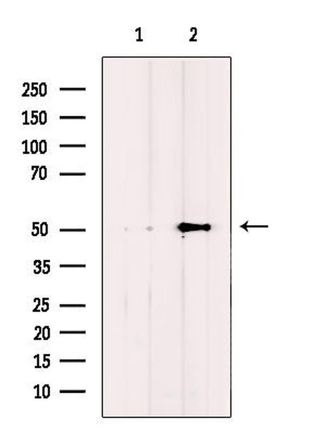 IFIT5 Antibody in Western Blot (WB)