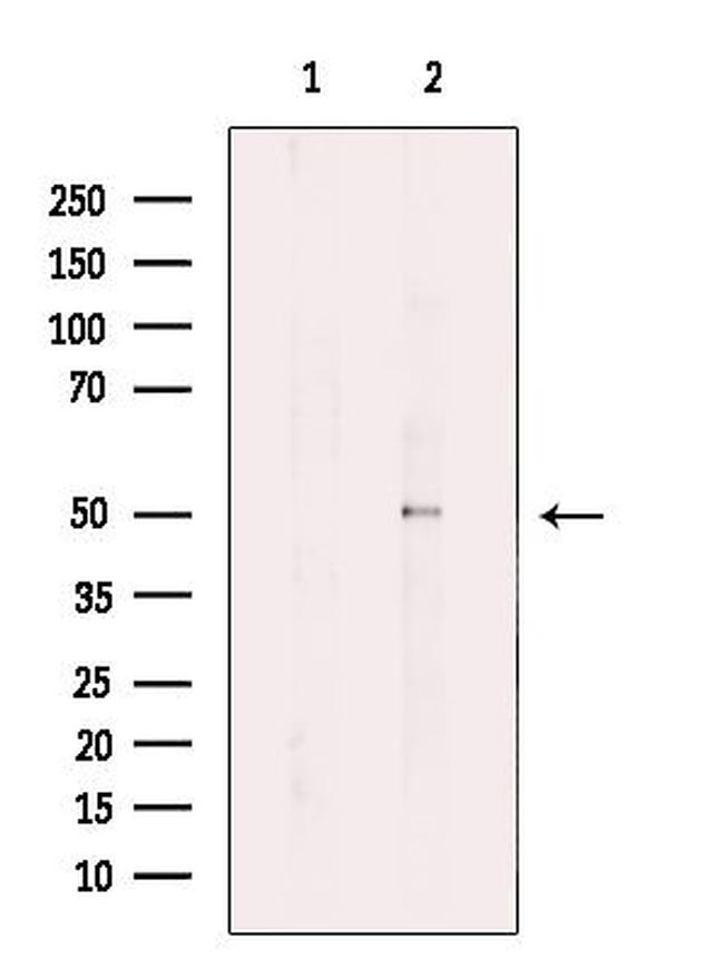 TUBA3C/TUBA3E Antibody in Western Blot (WB)