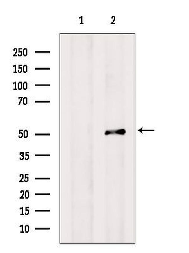 CYP3A7 Antibody in Western Blot (WB)