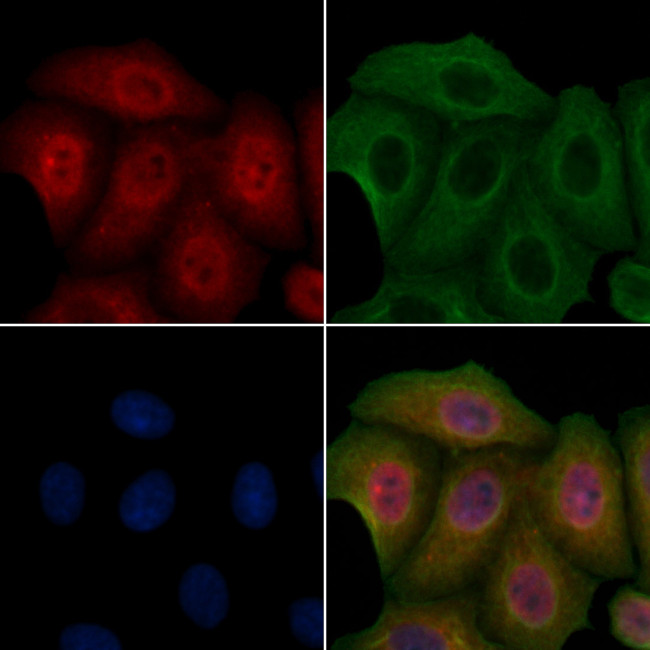 CK1 delta Antibody in Immunocytochemistry (ICC/IF)