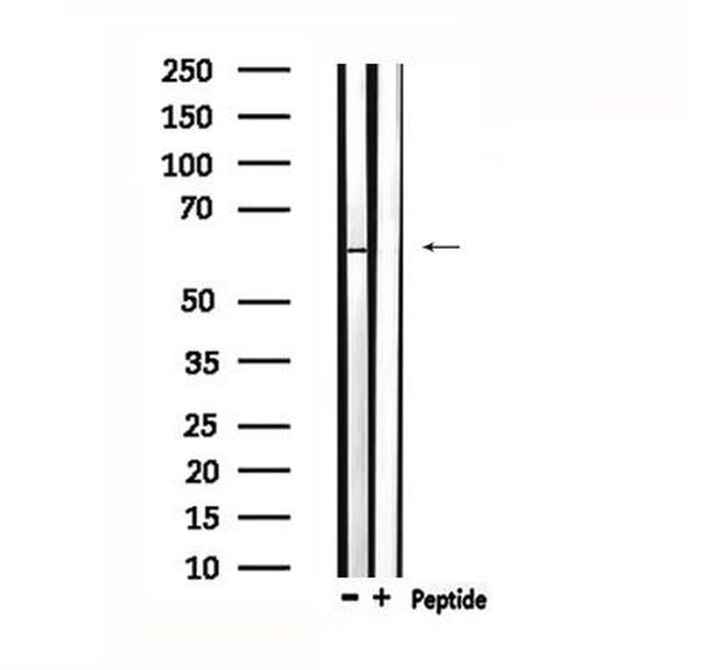 TESK2 Antibody in Western Blot (WB)