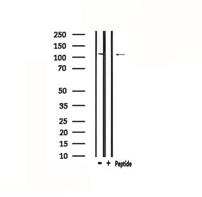 Desmoglein 1 Antibody in Western Blot (WB)
