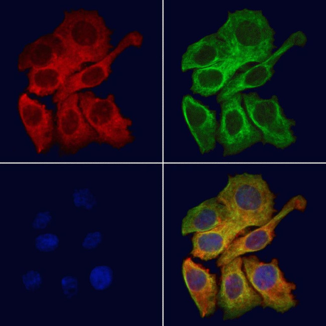 mPR gamma Antibody in Immunocytochemistry (ICC/IF)