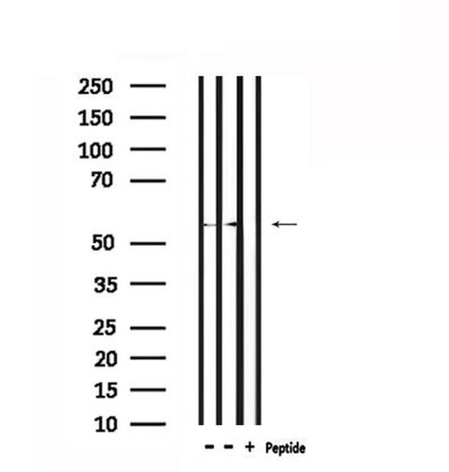 STIP1 Antibody in Western Blot (WB)