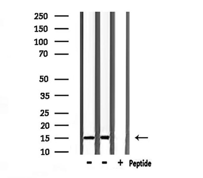 Substance P Antibody in Western Blot (WB)