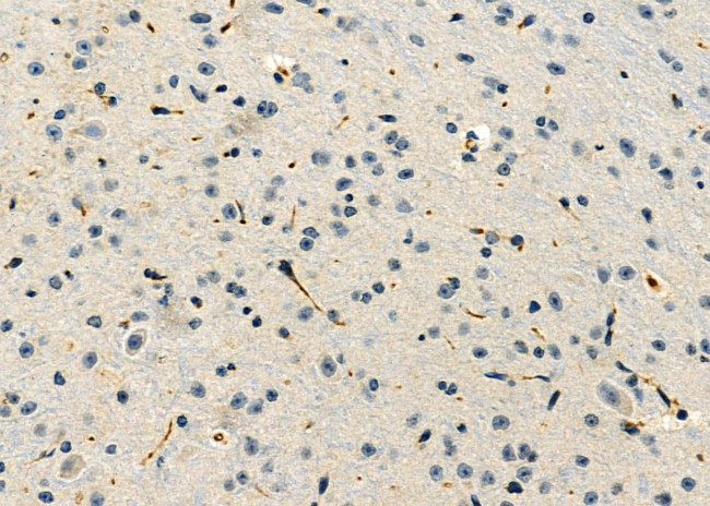 MPZ Antibody in Immunohistochemistry (Paraffin) (IHC (P))