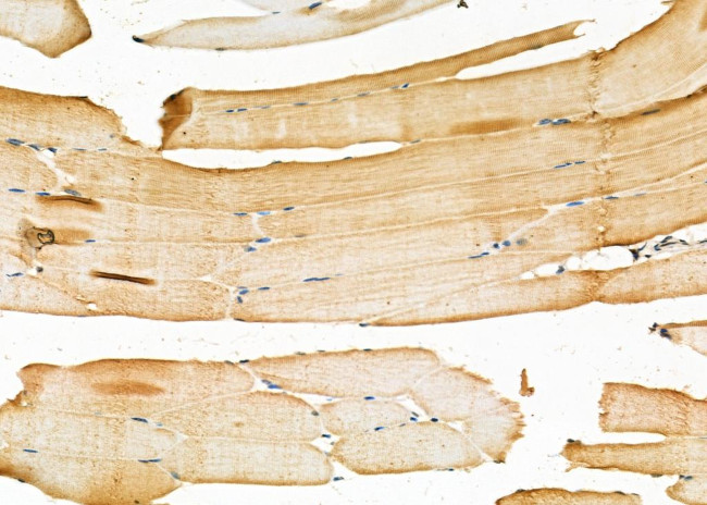 EXT1 Antibody in Immunohistochemistry (Paraffin) (IHC (P))