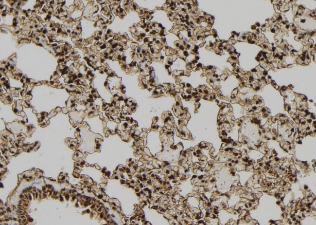 PDX1 Antibody in Immunohistochemistry (Paraffin) (IHC (P))