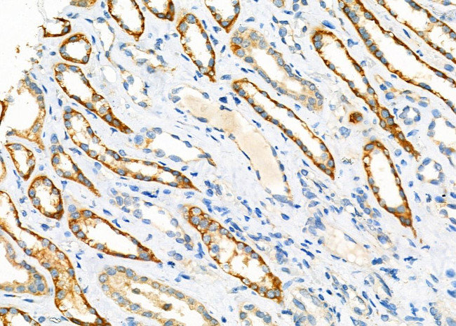 GARS Antibody in Immunohistochemistry (Paraffin) (IHC (P))