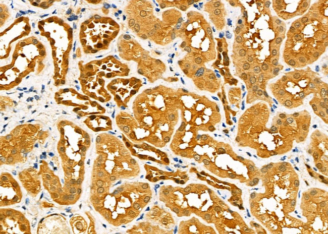 CBR1 Antibody in Immunohistochemistry (Paraffin) (IHC (P))