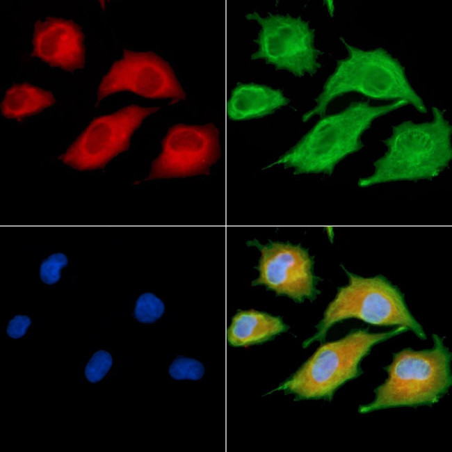 MAP1A Antibody in Immunocytochemistry (ICC/IF)