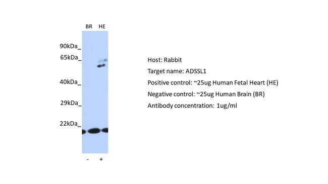 ADSSL1 Antibody in Western Blot (WB)