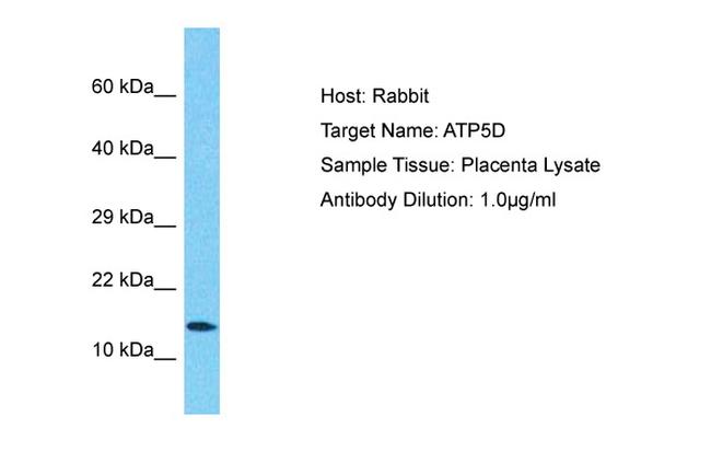 ATP5D Antibody in Western Blot (WB)