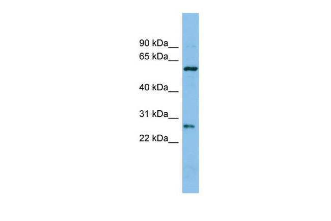 CTRB1 Antibody in Western Blot (WB)