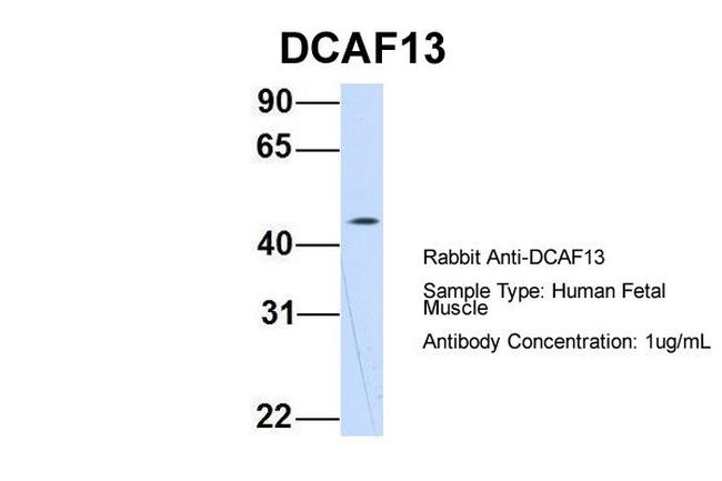 WDSOF1 Antibody in Western Blot (WB)