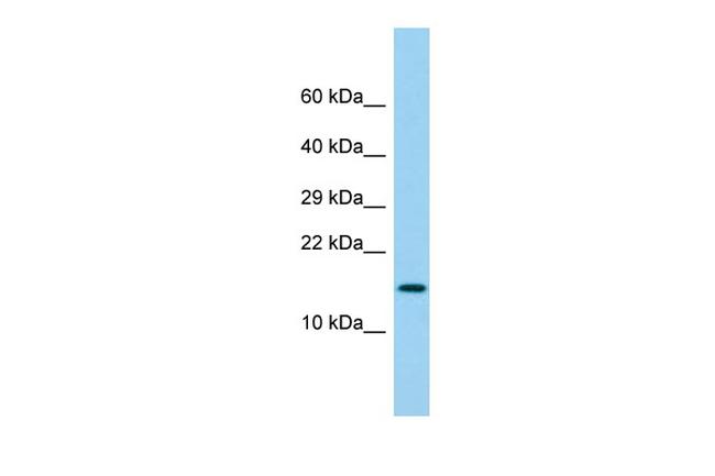 LY6G6D Antibody in Western Blot (WB)