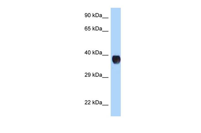 RHD Antibody in Western Blot (WB)