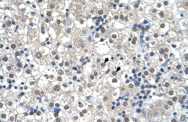 RTN2 Antibody in Immunohistochemistry (IHC)