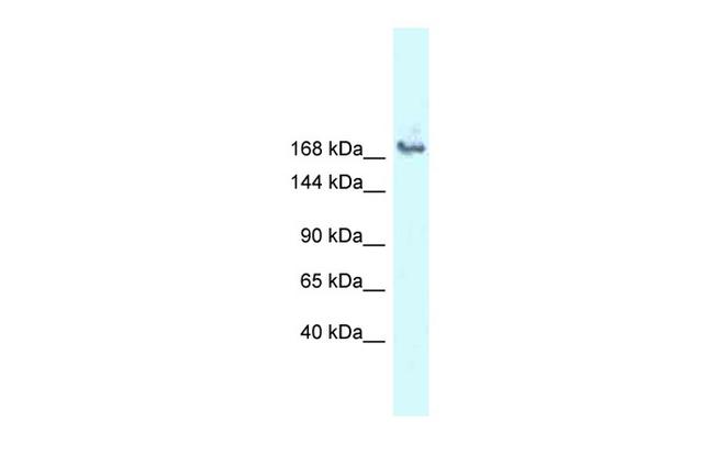 SNRNP200 Antibody in Western Blot (WB)