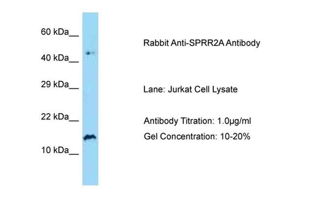 SPRR2A Antibody in Western Blot (WB)