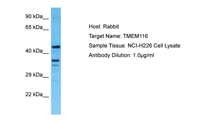TMEM116 Antibody in Western Blot (WB)