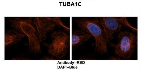 TUBA1C Antibody in Immunohistochemistry (IHC)
