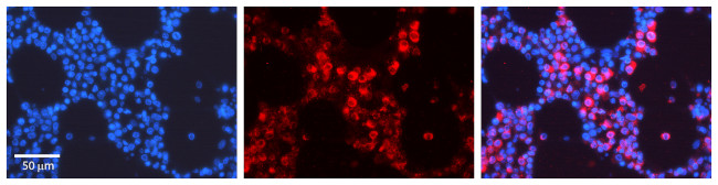 TUBB2A Antibody in Immunohistochemistry (Paraffin) (IHC (P))