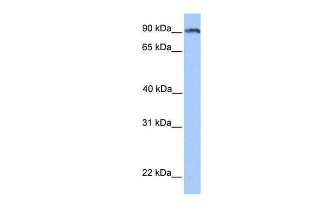 ANKS3 Antibody in Western Blot (WB)