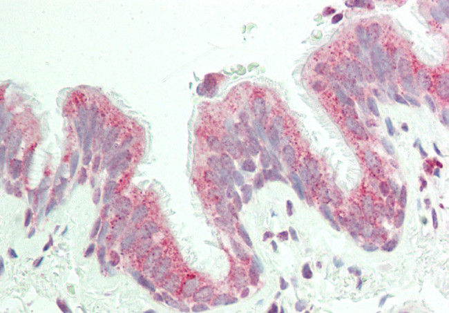 KIAA0317 Antibody in Immunohistochemistry (IHC)
