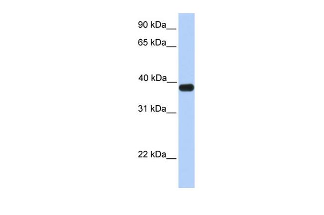 ASB5 Antibody in Western Blot (WB)
