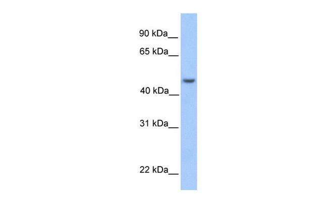 ASB6 Antibody in Western Blot (WB)