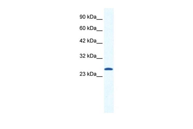 CACNG6 (extracellular) Antibody in Western Blot (WB)