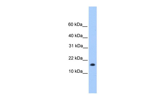 CENPW Antibody in Western Blot (WB)