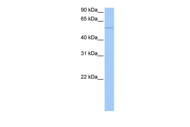 CHN1 Antibody in Western Blot (WB)
